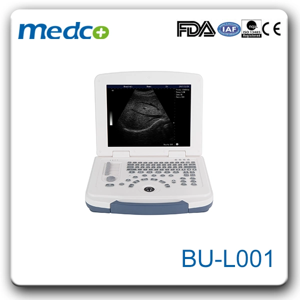 Tragbarer S/W-Ultraschallgerät und Laptop-Ultraschallscanner