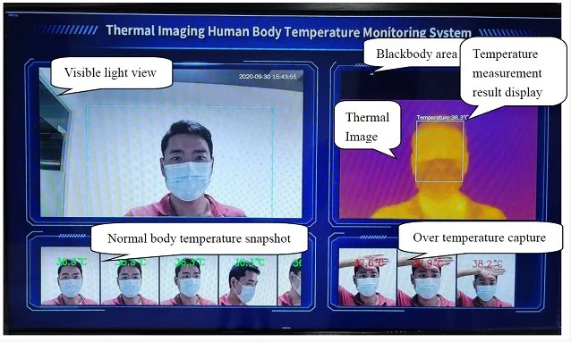 L'imagerie thermique thermomètre intégré