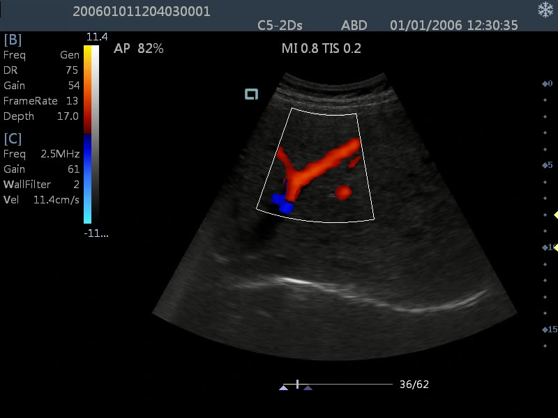 Am-5000 Full-Digital Color Doppler Ultrasound Diagnostic System Ultrasound Scanner