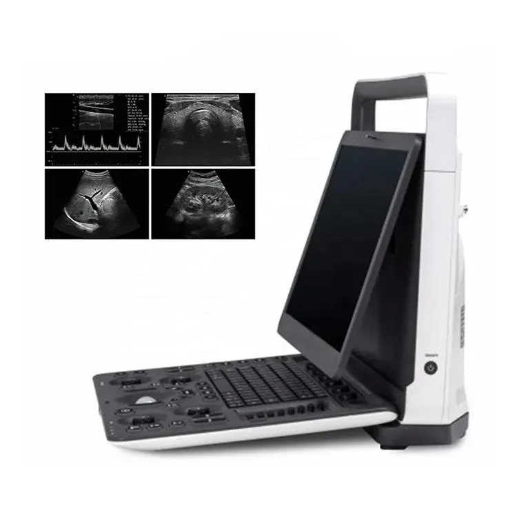 Sonoscape E2 Portable Doppler Ultrasound Machine for Medical