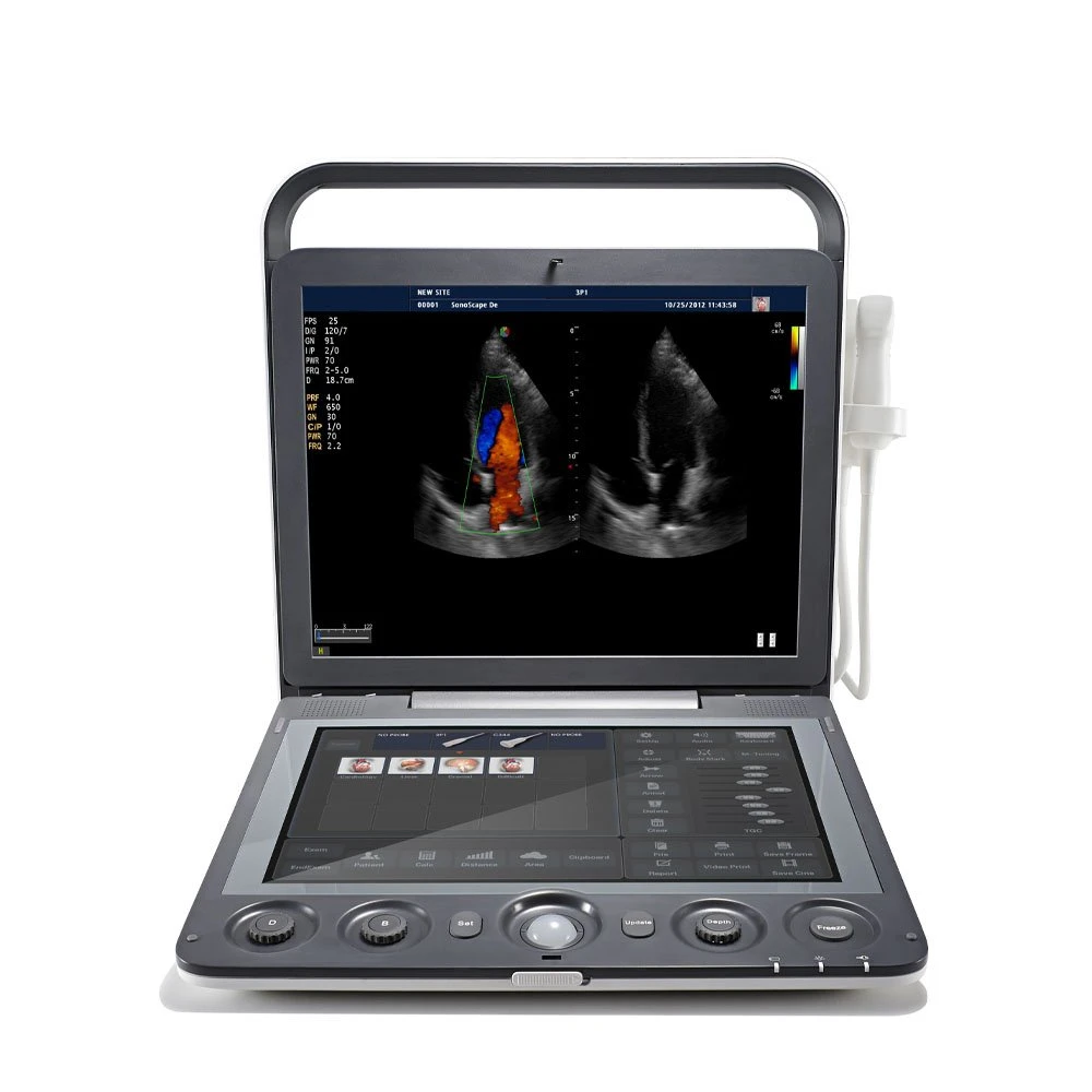 Sonoscape S9 Medical Ultrasound ultrasonic Instruments, Portable Color Doppler 4D Ultrasound Machine