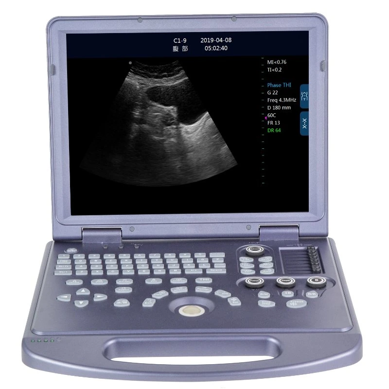 Pw HD Live El Sistema de Diagnóstico por Ultrasonidos