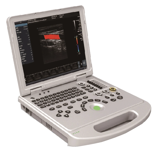 Cheap Price Color Doppler Ultrasound Machine Portable Ultrasound Scanner