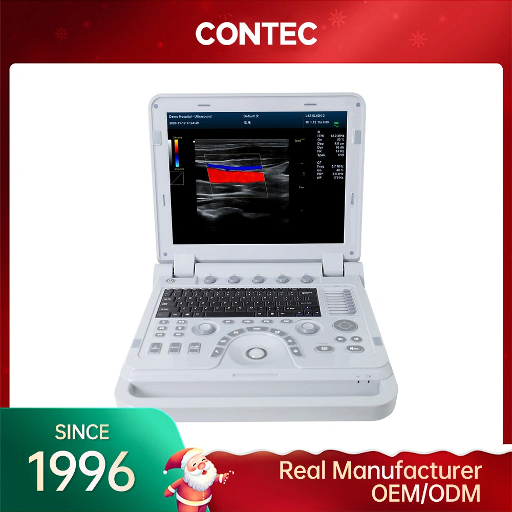 Contec Cms1700A Convex Array Extended Imaging Online Technical Support Ultrasound Máquina