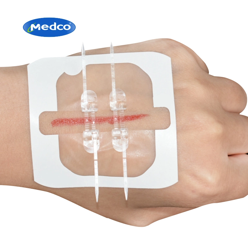 Medical Disposable Devices Non-Invasive Adhesive Wound Closure Zipper