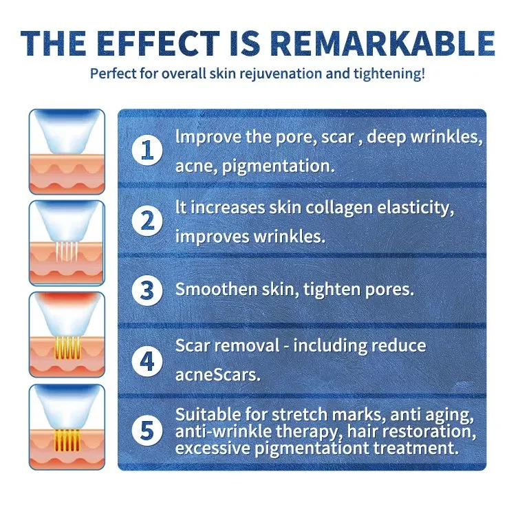 Garantie de 2 ans, serrage de la peau de la micro-aiguille fractionnelle RF la plus récente / RF fractionnelle microneedle radio fréquence cicatrice révision RF facial Appareil de beauté