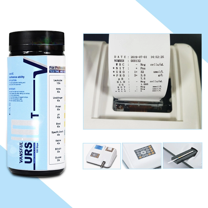 Hot Selling Product Urine Sediment Analyzer Automated Portable Urinalysis Machine