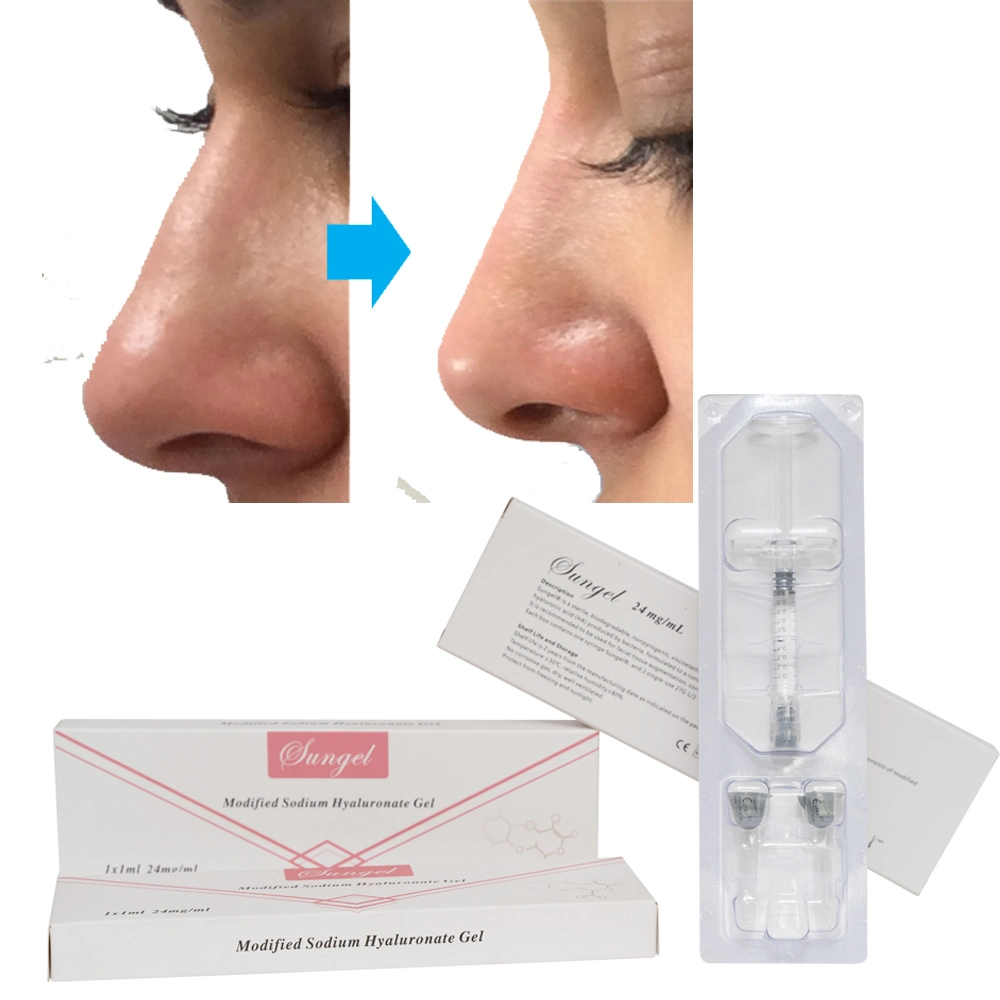 Produtos de beleza Medical Micro 1 ml de ácido hialuornic indolor BD injection Com lidocaína