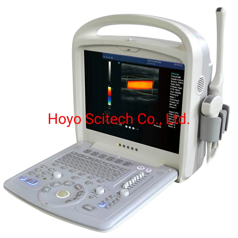 Color Doppler Portable Ultrasound Doppler Ultrasound Scanner
