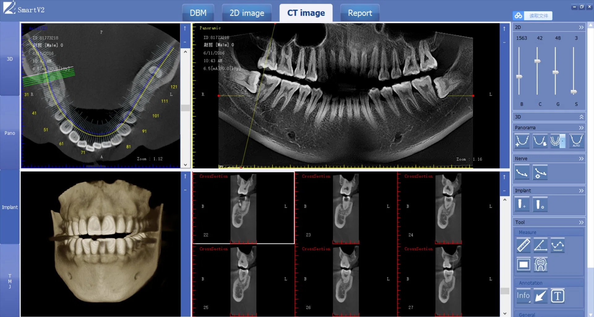 3D Dental Panoramic Xray Machine Cbct Dental X Ray Machine Dental Equipment