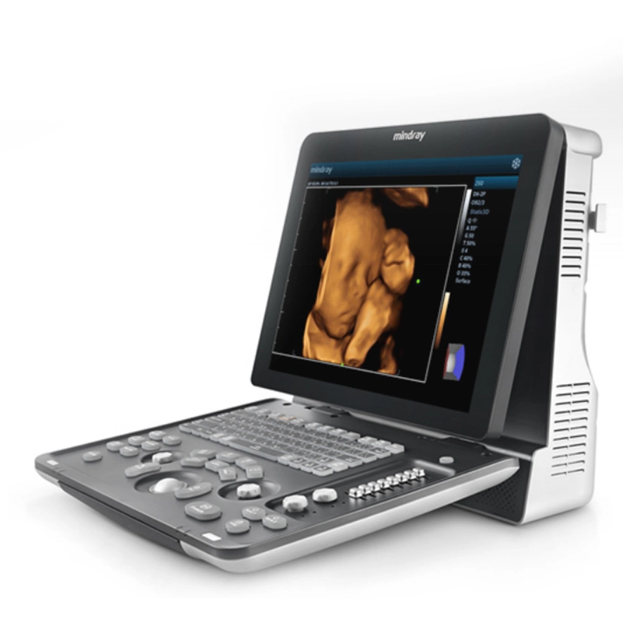 Z60 Mindray/Sonoscape/Zoncare/Chison Laptop/Portable/Trolley-Farb-Ultraschallscanner