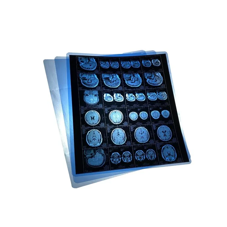 Wholesale/Supplier for Universal Blue Based Pet Inkjet Medical X-ray Film 175um for Radiology Department