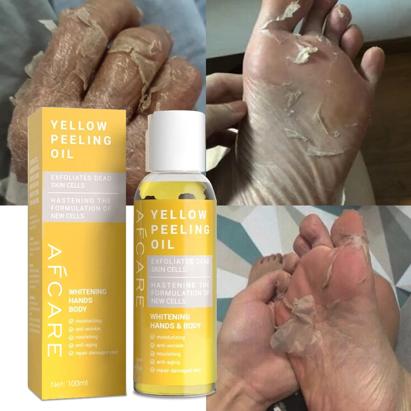 Etiqueta privada más eficaz Whitening piel Amarillo Peeling aceite para Nudillos oscuros