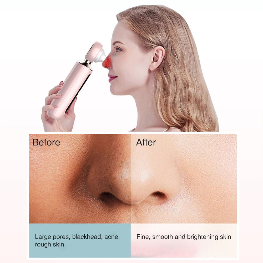 Home Use Skin Care Nose Blackhead with Magnifier