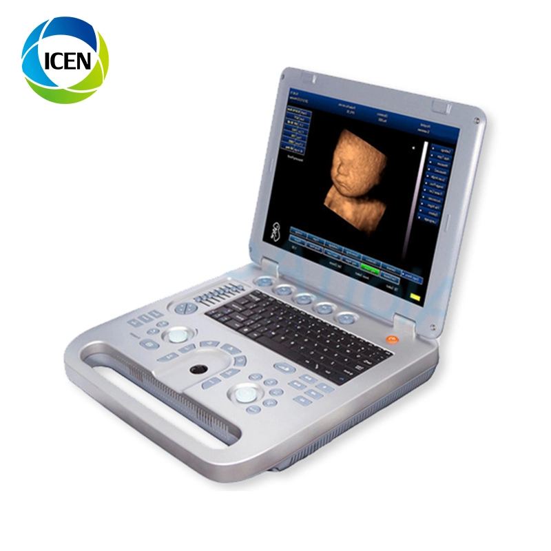 IN-A8 Portable 3D 4D Color Doppler Pregnancy  Probe Ultrasound  Scanner