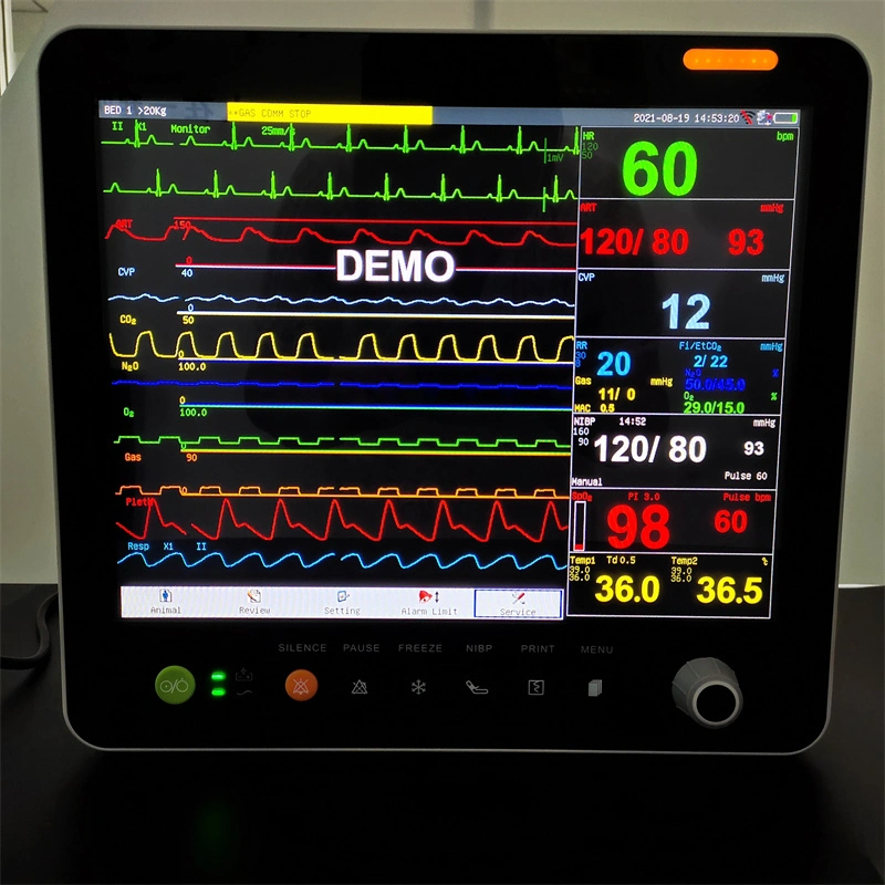 El equipo de médicos veterinarios Multi-Parameter Monitor de paciente de 15 pulg.