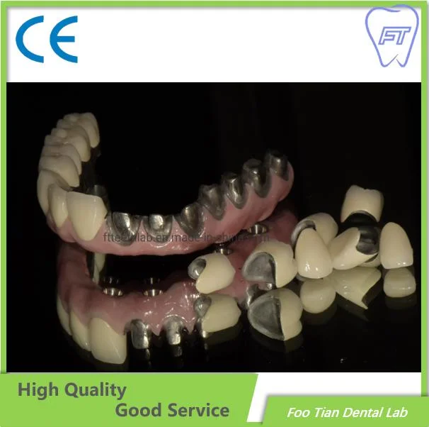 Ponte de Implante Fresada por CAD/CAM Dental de um Laboratório Dentário da China.