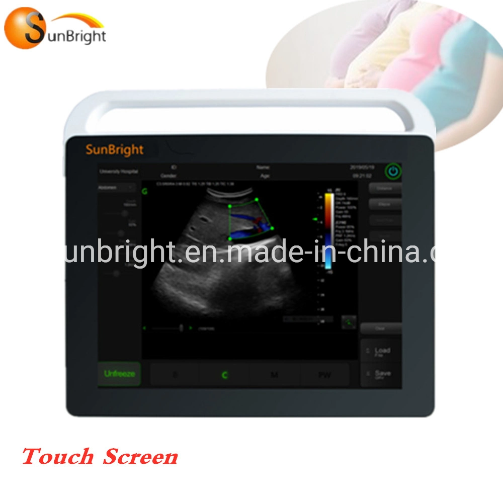 Sun-800s Handheld Portable 2D Ultrasound Machine Touch Screen Echo