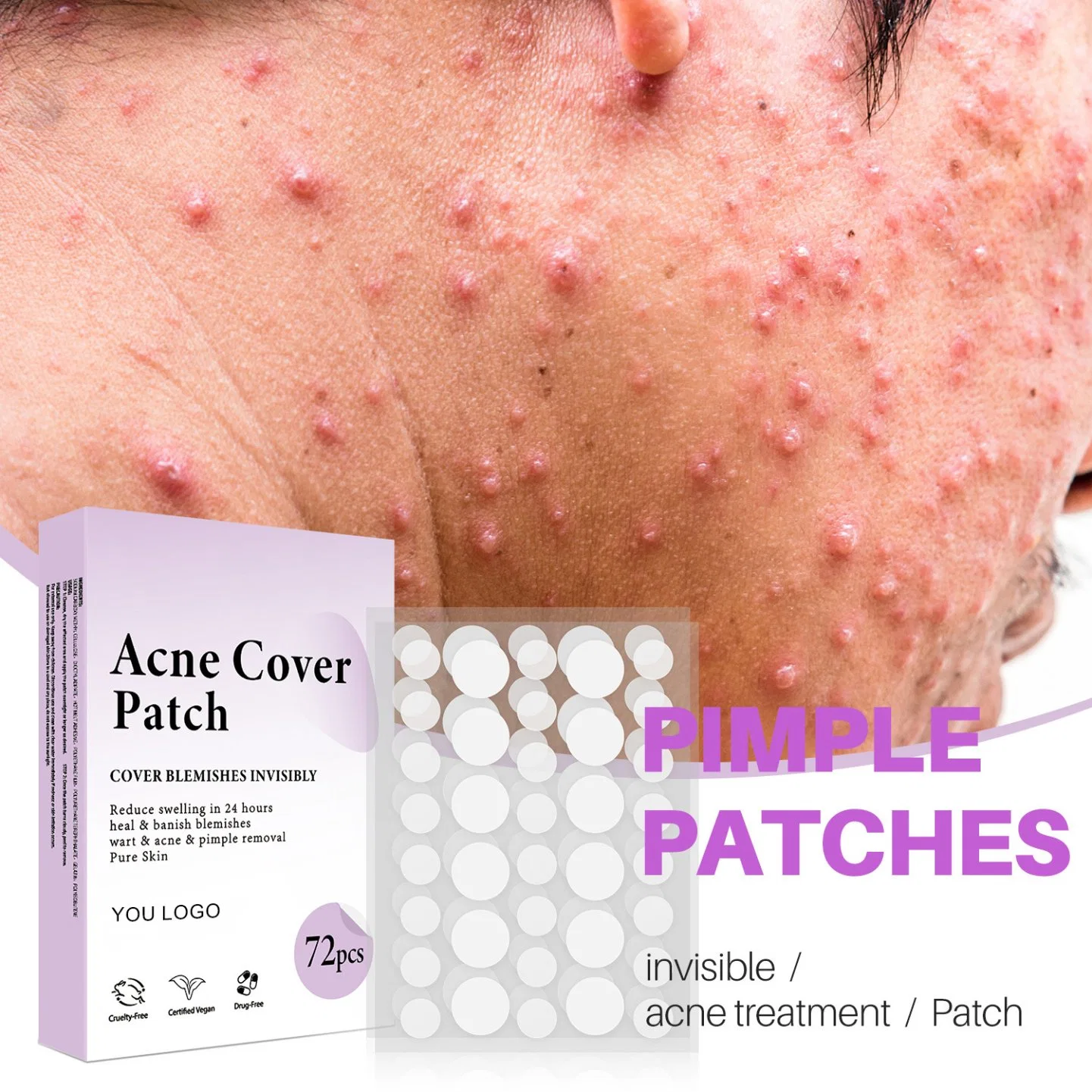 Beauty Cosmetics Skin Care Pimple Patch Blemishes Breakouts Spot Treatment Facial Stickers