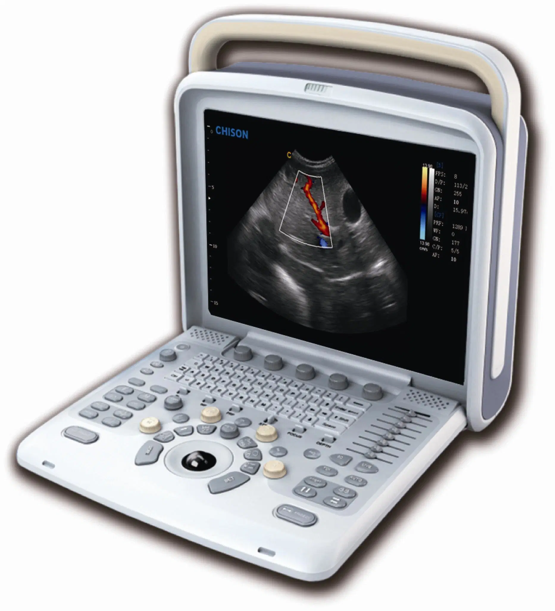 Medical Vet 4D Color Doppler Portable Ultrasound Scannere Machine