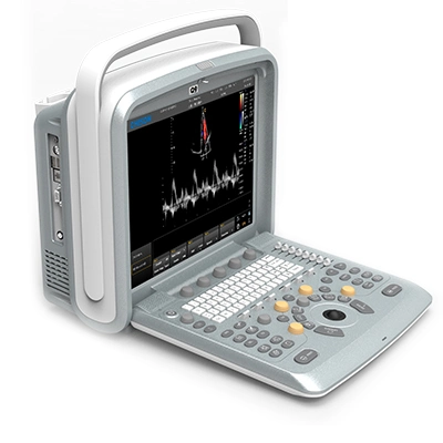 Chison Q9 Portable Color Doppler Ultrasound System