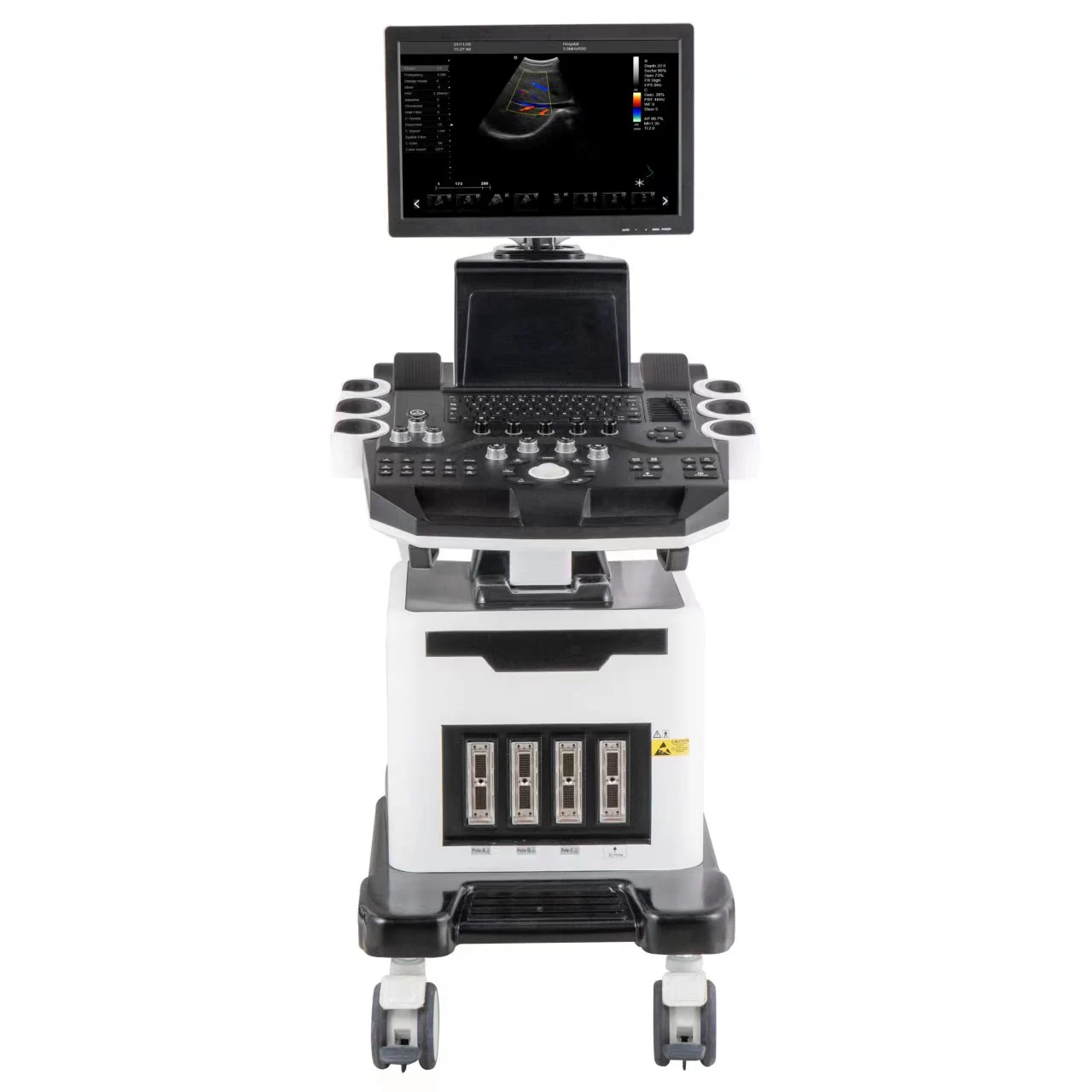 Vascular Orthopedics Full Digital Trolley 4D 5D Doppler Color Ultrasound Scanner Machine