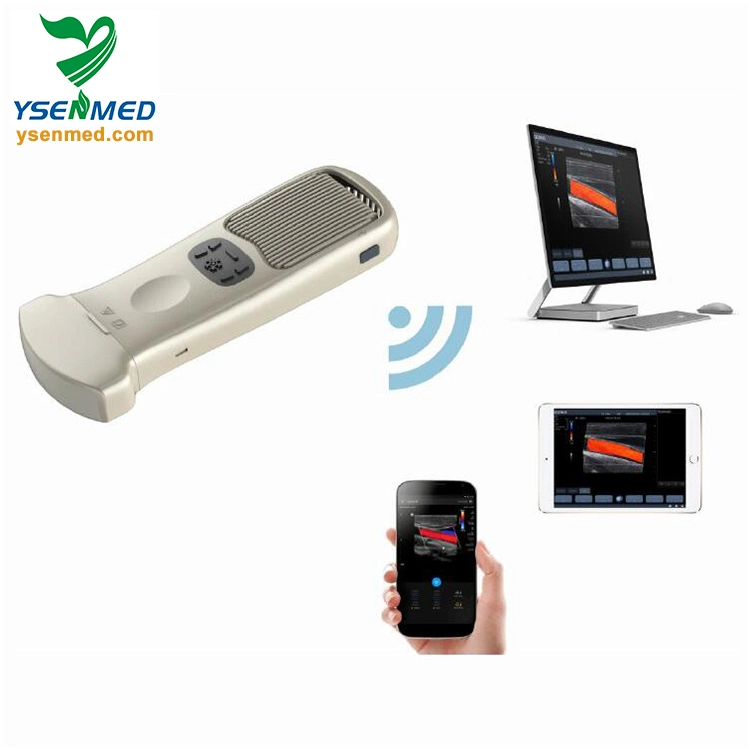 Medical Ysb363 WiFi Connected Instrument Portable Wireless Ultrasound Machine