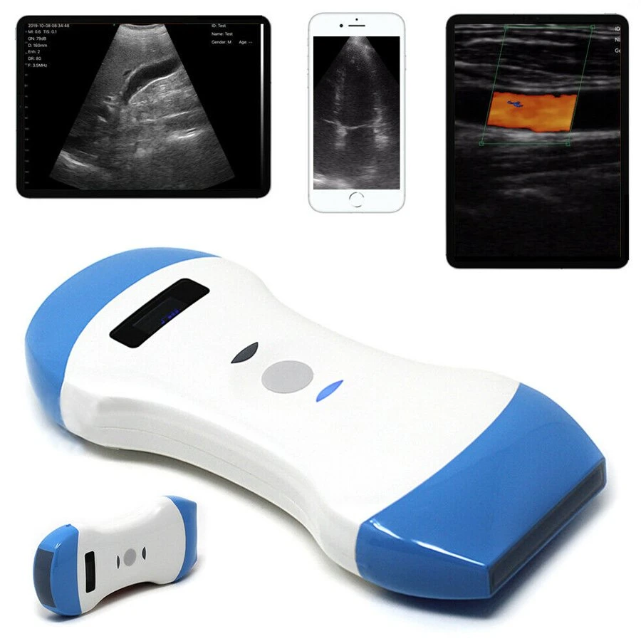 Três-em-um Doppler portátil array eletrônico color Doppler ultra-som portátil Scanner preço barato