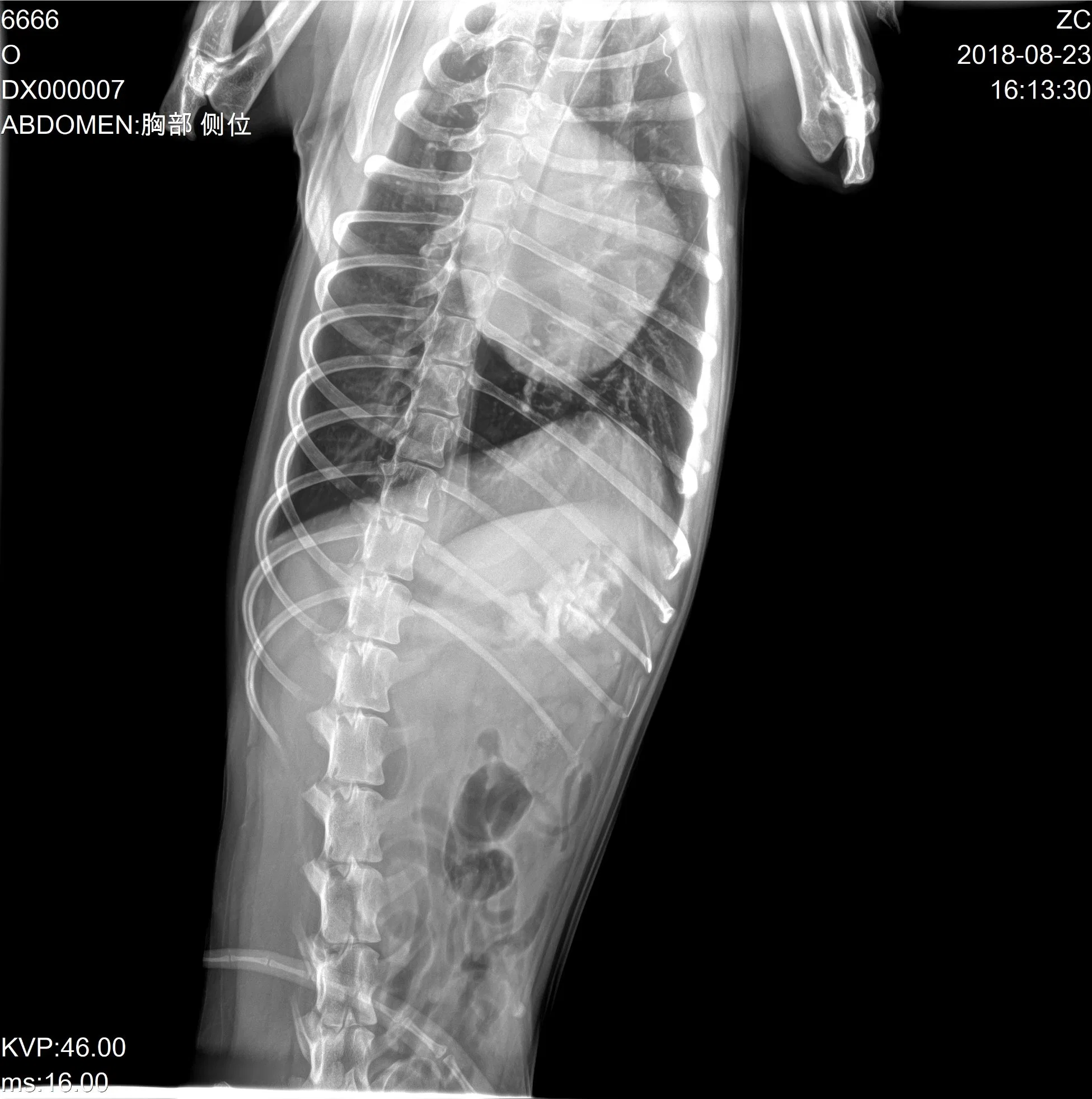 Détecteur à écran plat numérique sans fil avec le logiciel et de la machine à rayons X Iray Mars 1417V Prix Dr système matériel de radiologie CR &amp; accessoires