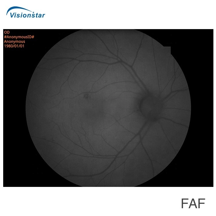 With FAF Function Non-Mydriatic Auto Focus Reticam 3100 Retinal Fundus Camera