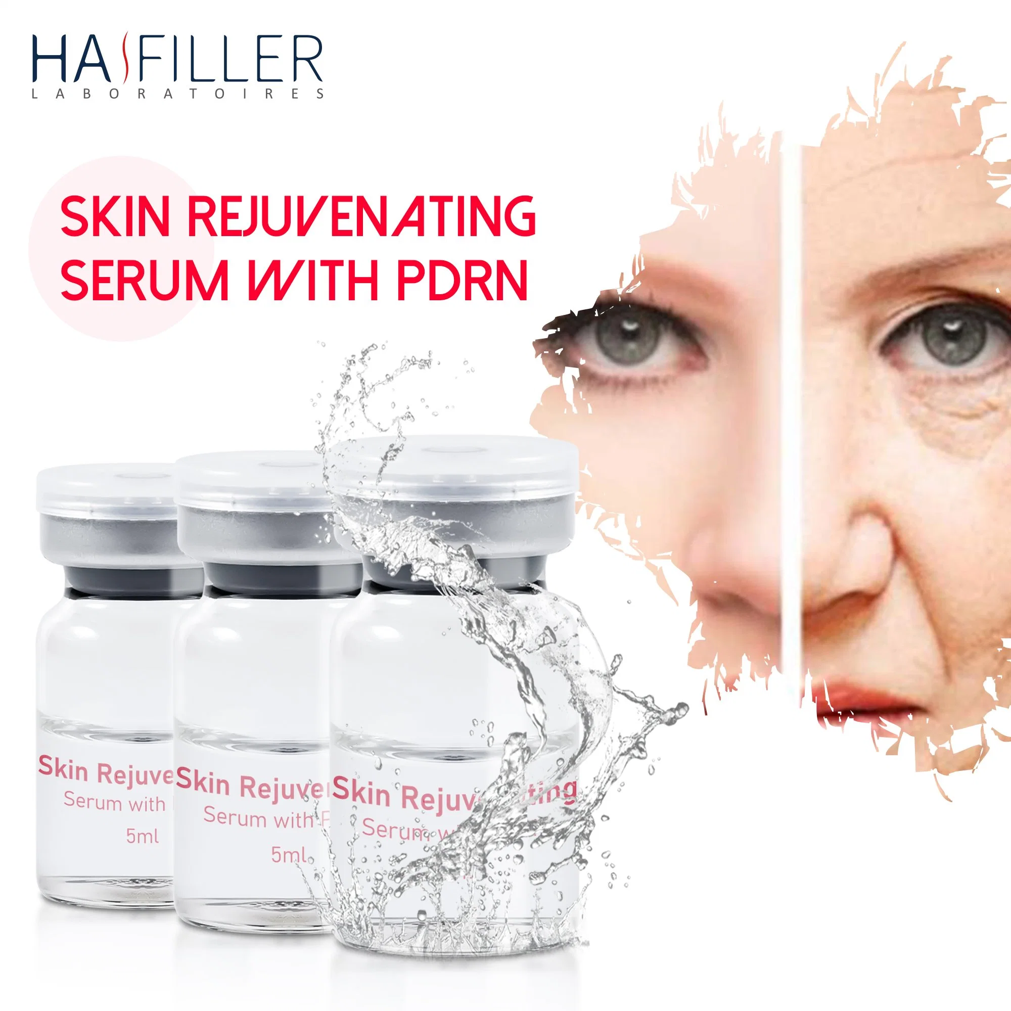 Großhandel/Lieferant Haut Verjüngen Serum Enthalten Pdrn Anti Aging Skinbooster Hyaluronic Acid Pdrn Injektionslösung Für Mesotherapie