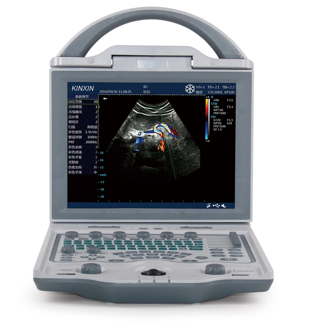 Factory Direct Supplier Digital Color Portable Vet Doppler Veterinary Ultrasound Scanner