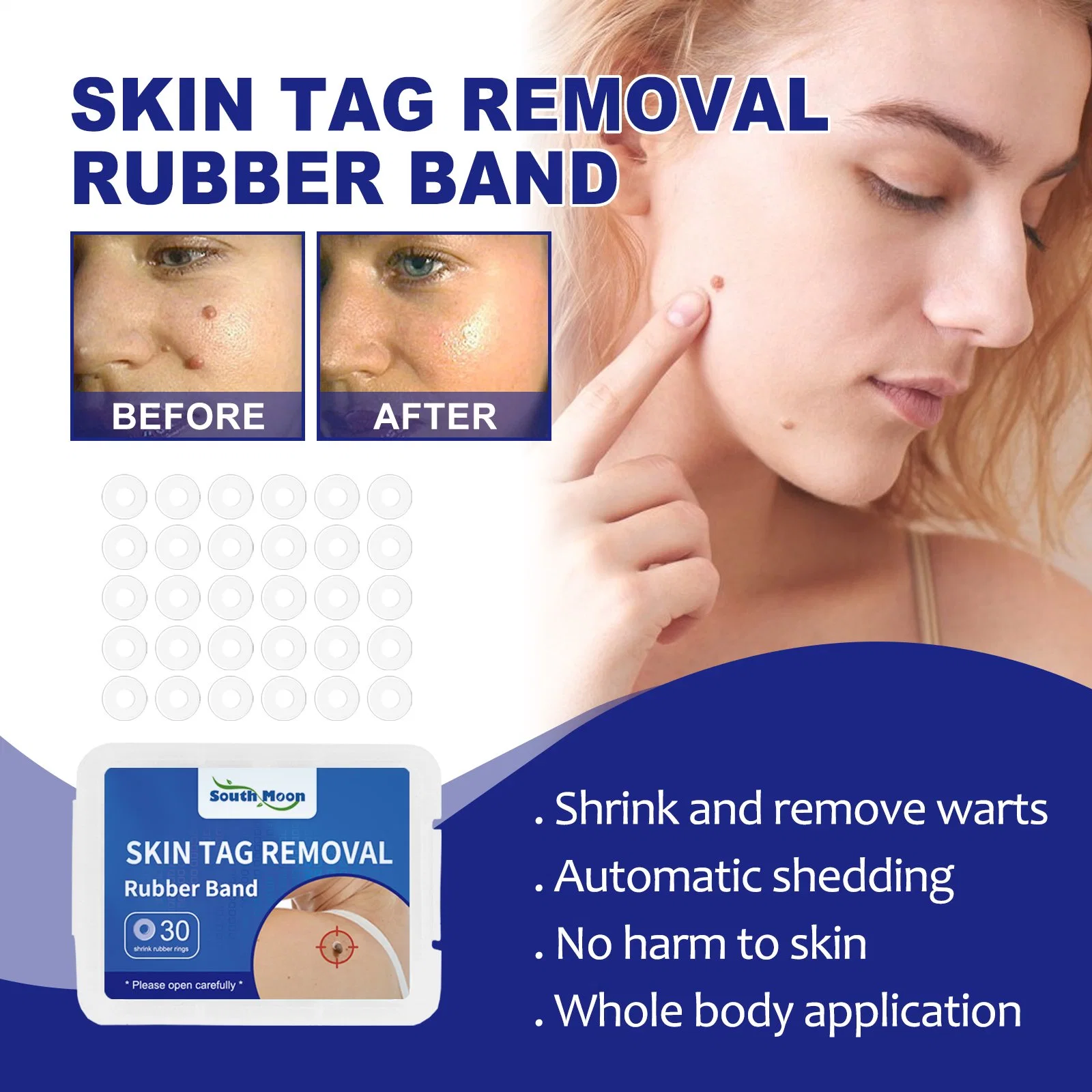 Skin Tag Remover Band Mole Wart Acne Pimple Patch Removal Spot