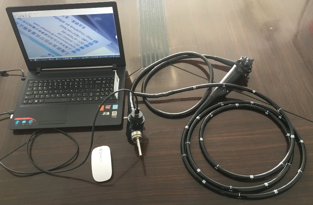 Portable USB Video Gastroscope & Colonoscope & Duodenoscope Set for Surgery Use