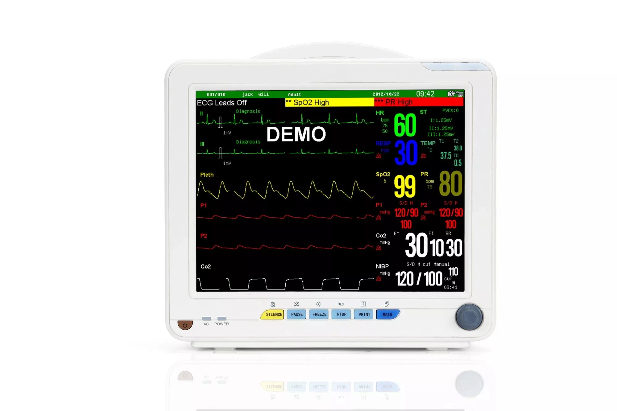 Medical Hospital Equipment Portable Multi-Parameter Vital Sign Patients Monitors