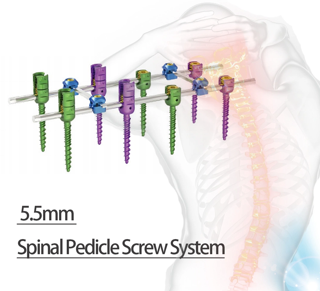 Original Factory 5.5 Breakable Polyaxial Pedical Screw