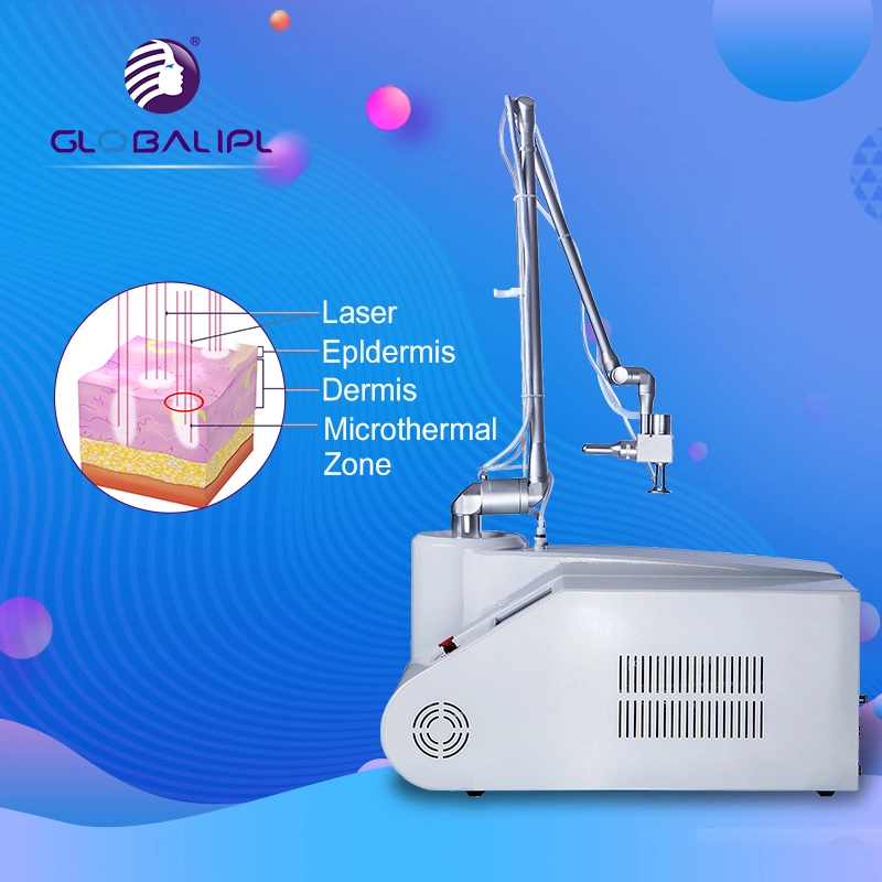 Portable Laser fracional de equipamentos de beleza