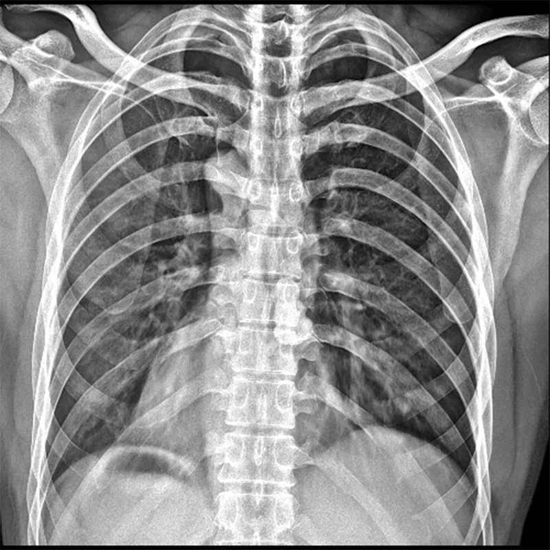 Лучшая цена 17*17 беспроводной портативный плоской панели X Ray детектора Dr плоскопанельного детектора плоскопанельного детектора