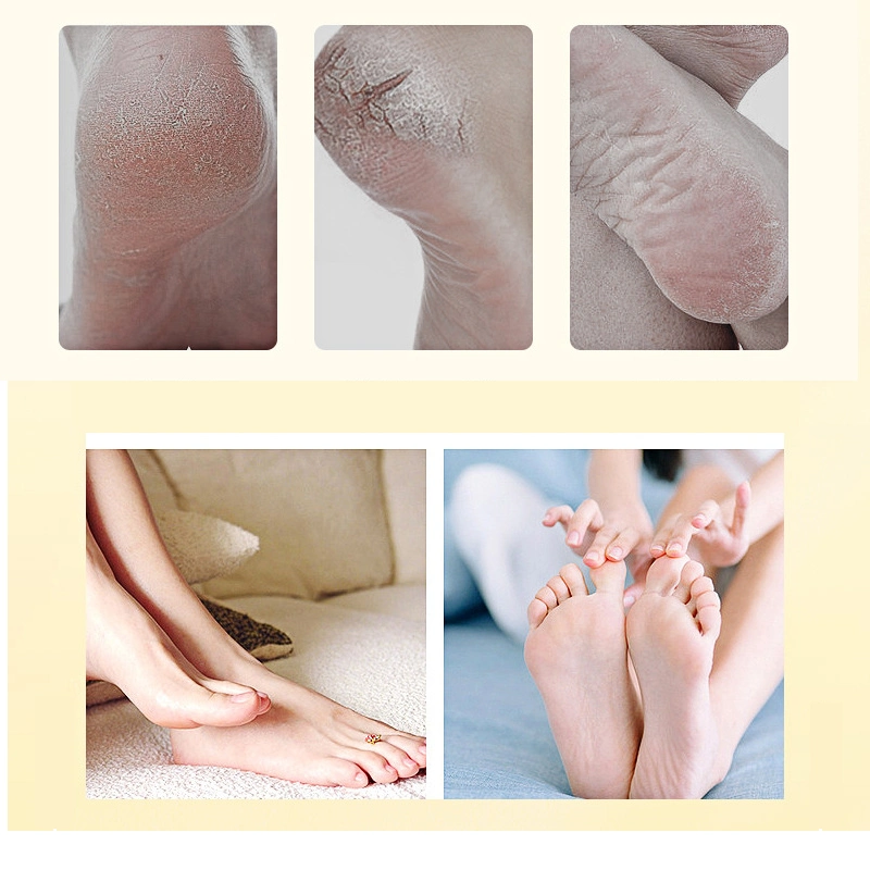 Low MOQ Custom Logo Anti Dry Cracked Heels Feet Care Cream Intensive Moisturizing Whitening Repair Foot Repair Cream