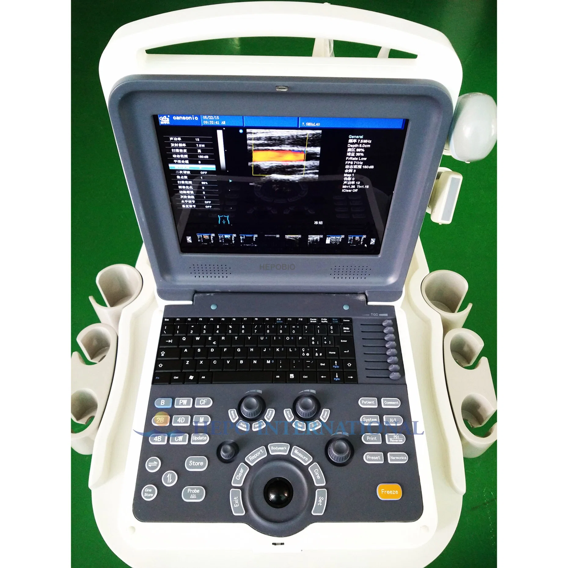 Tragbares Ultraschallsystem für das Krankenhaus, 4D-Farb-Doppler-System