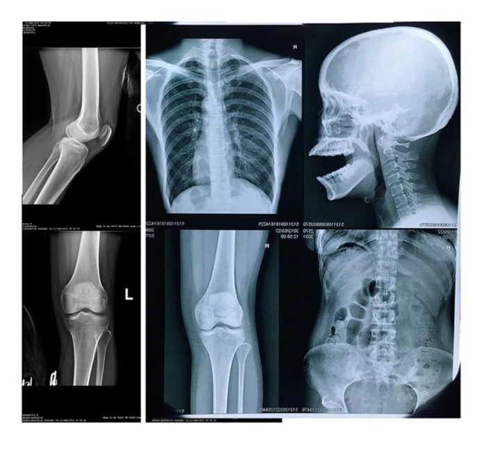 Película azul descartável de alta qualidade branca e laser com base em azul Imprimir película de raios X seca para fins médicos