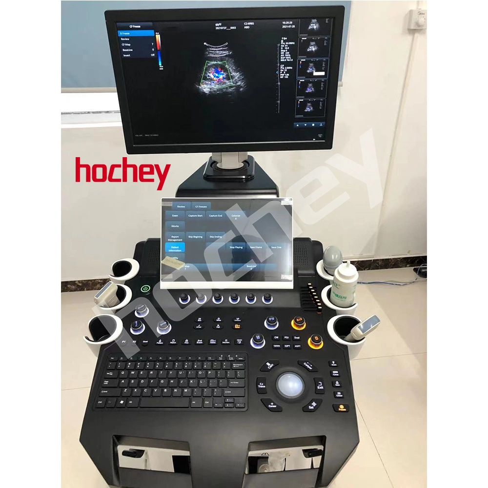 La facilidad de uso médico de hochey 3D 4D de multilingüe ecógrafo portátil con carro