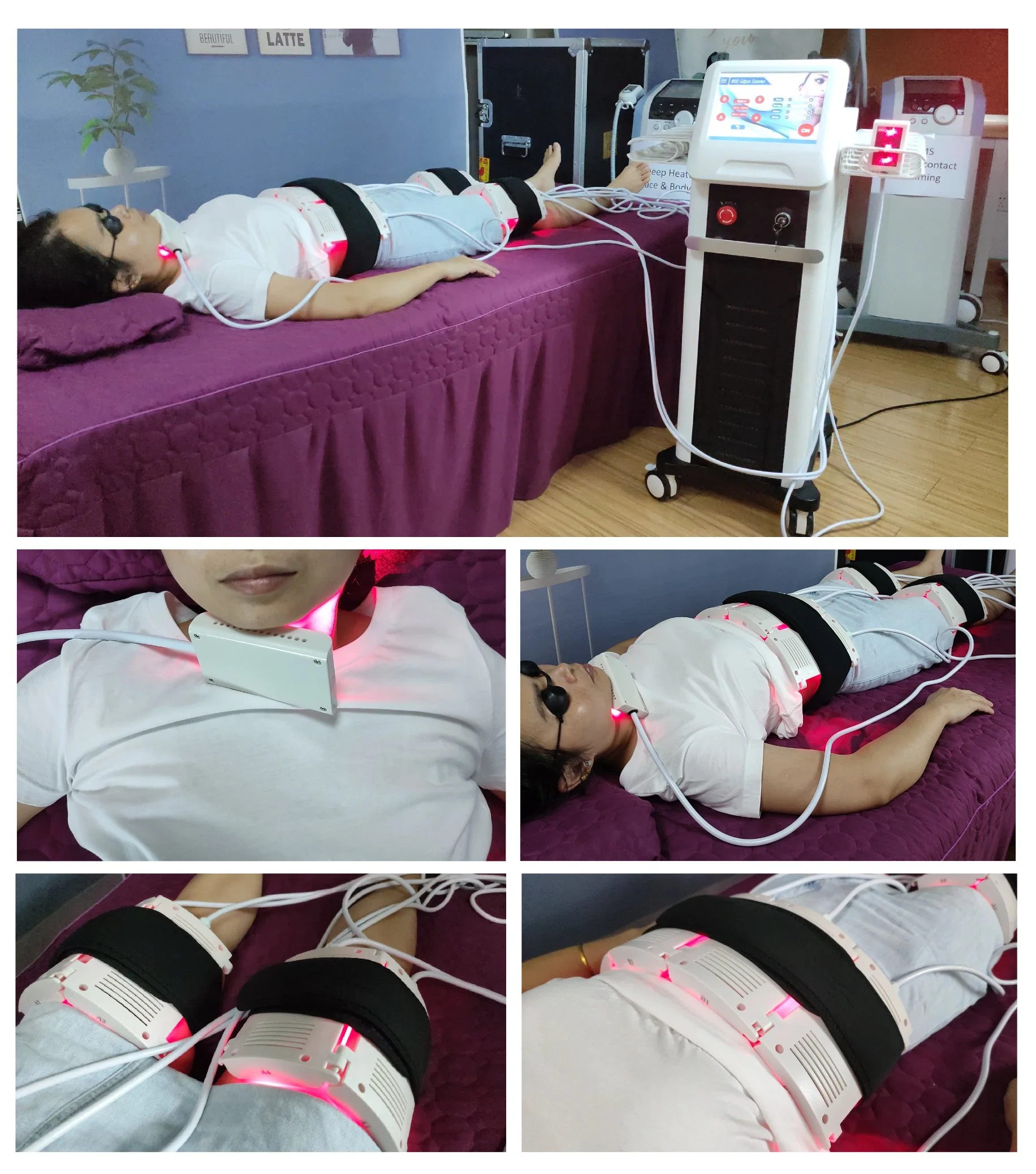 5D Lipo Laser Slimming Machine Extracción de celulitis con Mitsubishi Laser Lámparas