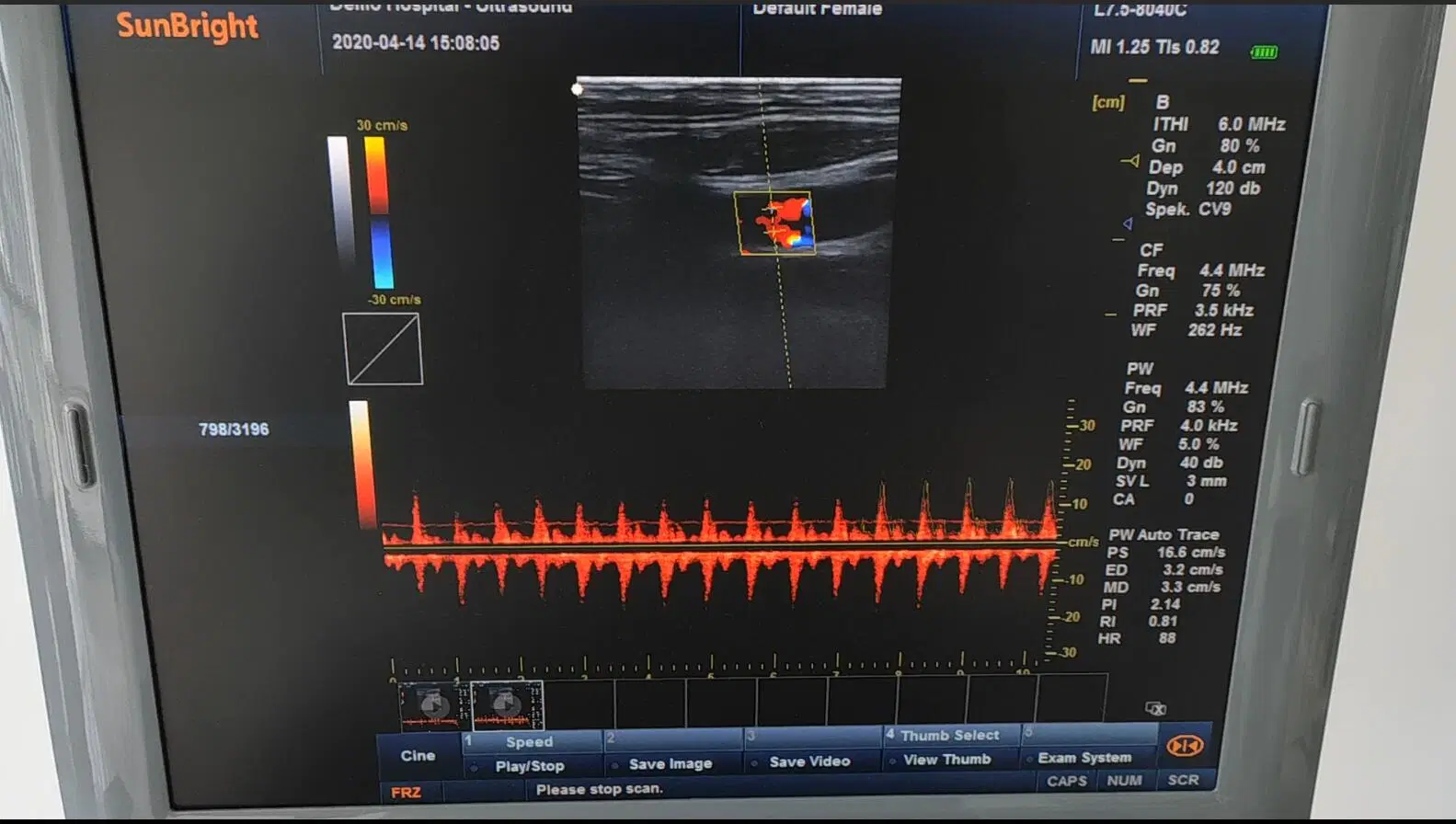 Doppler Color de alta gama máquina de ultrasonido Doppler de captura de animales el uso veterinario.