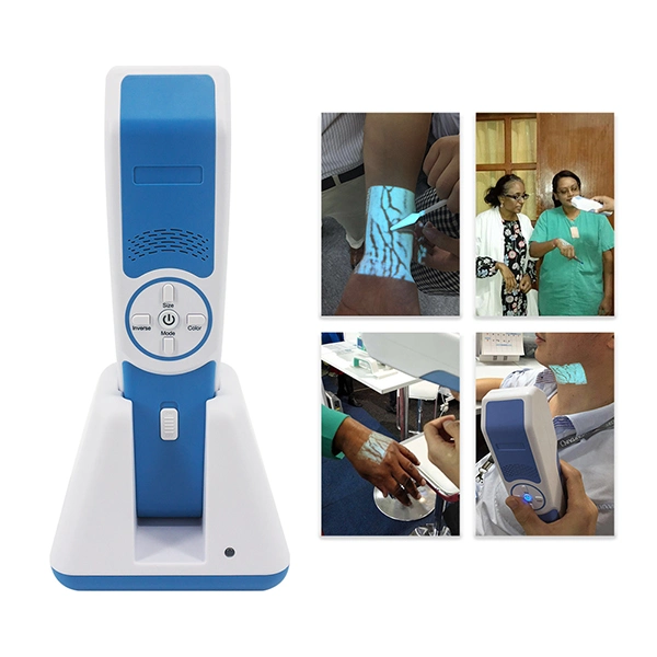 Portable Medical Infrared LED Light Projection Vein Detector