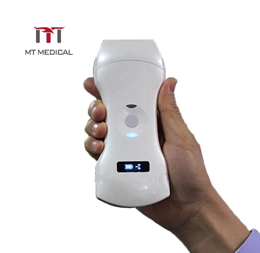 Mt Medical Newest Mini WiFi 192 Elements/ Portable Double Head Wireless Color Doppler Ultrasound/ Three Probe Scanner