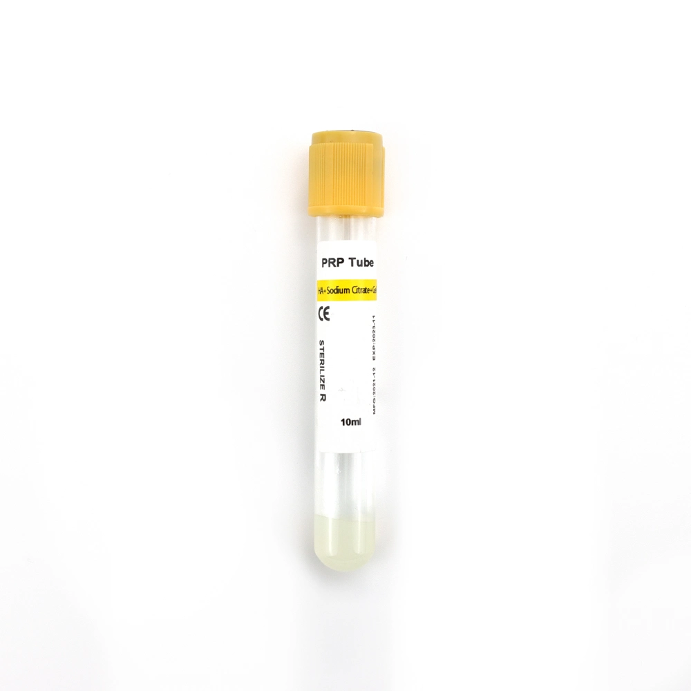 Siny 10ml Sodium Citrate Prp Tube