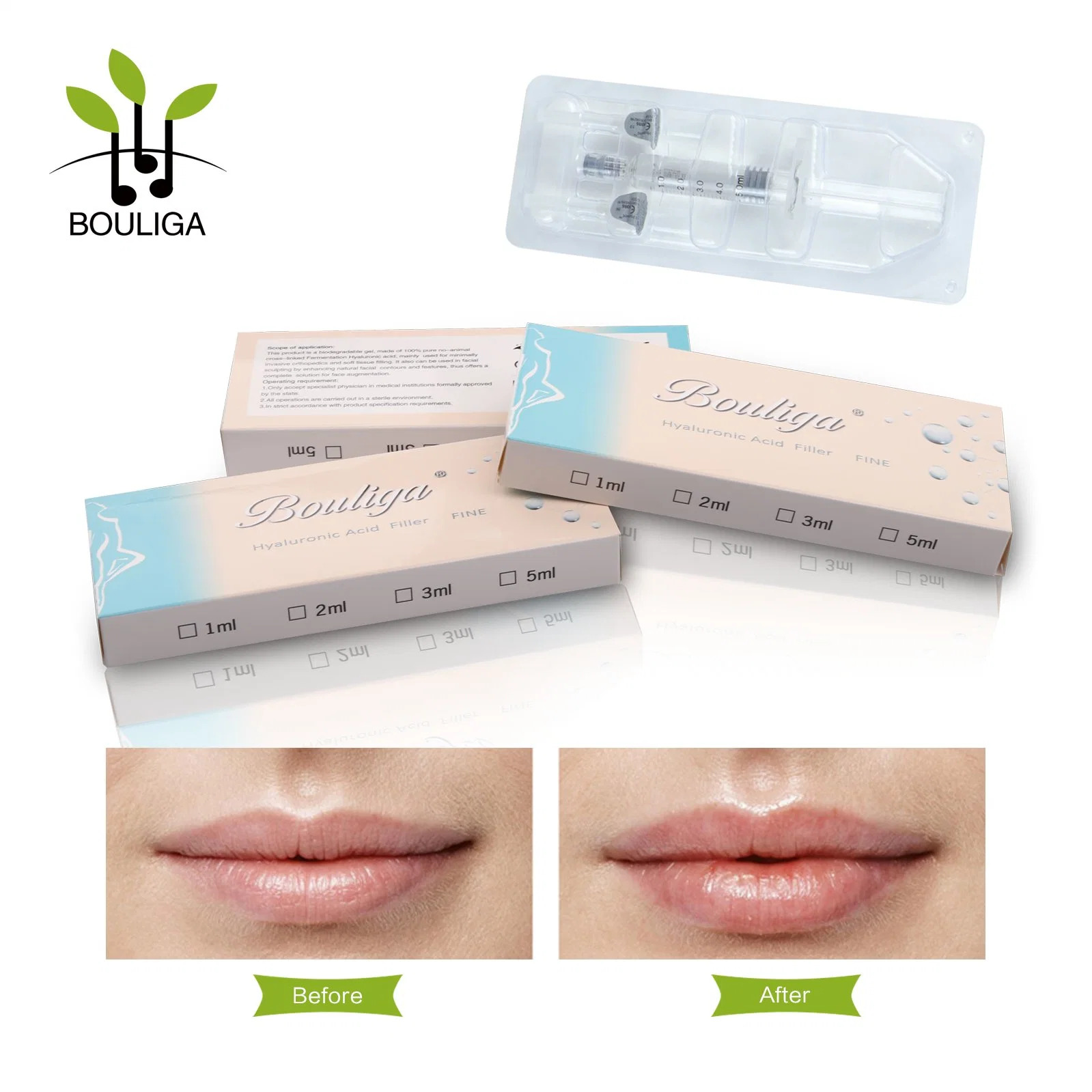 Bouliga Injectable Dermal Facial Filling 5ml Cheek Augmenation Hyaluronic Acid Dermal Filler