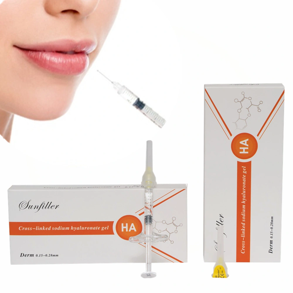 L'acide hyaluronique Sunfiller 2ml solution injectable Voie cutanée de remplissage pour la lèvre plénitude