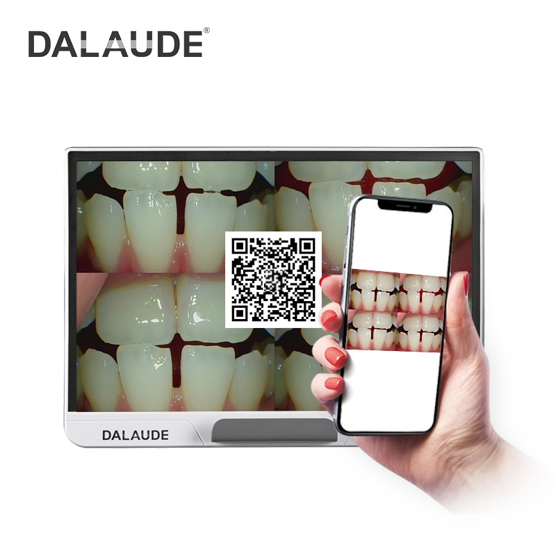 Video and Picture Transmission Function of Dental Oral Endoscope with Large Display